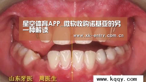 星空体育APP_微软收购诺基亚的另一种解读(图1)
